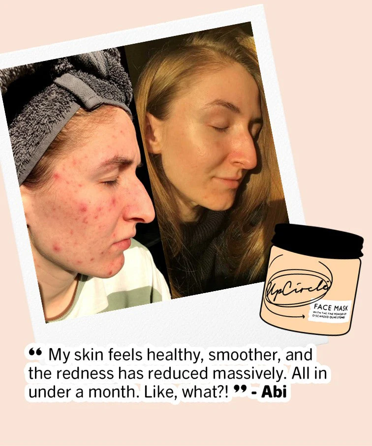 UpCircle Clarifying Face Mask with Kaolin Clay - Image 5