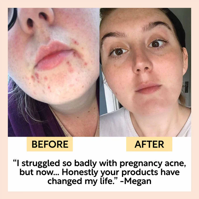 UpCircle Face Moisturiser with Vitamin E - Image 6